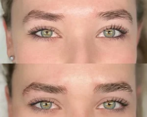 Eyebrow Tattooing