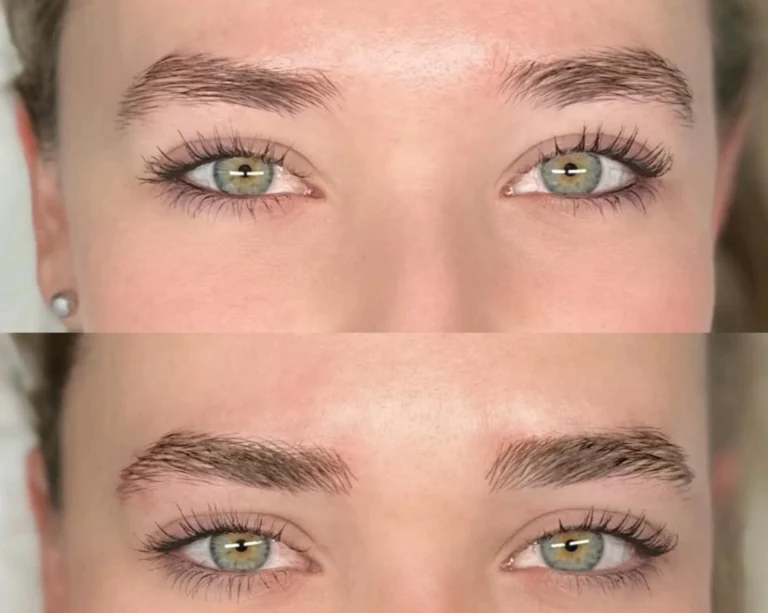 Does Hair Grow Over an Eyebrow Tattoo? Expert Insights
